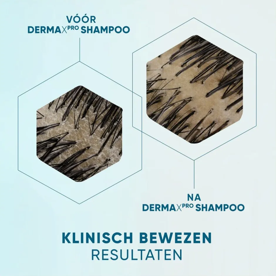 Outlet Head & Shoulders DermaXPro by Kalmeert Antiroosshampoo