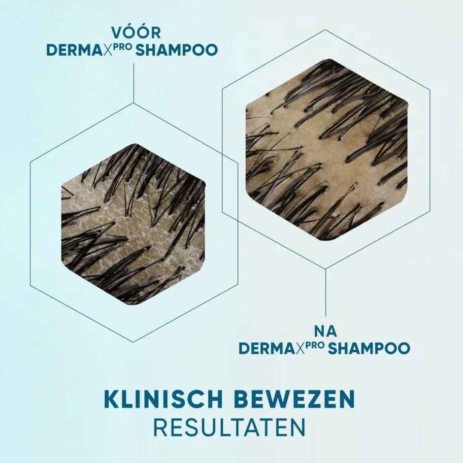 Discount Head & Shoulders DermaXPro by Hydrateert Antiroosshampoo