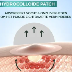 Outlet Garnier Skin Naturals Garnier PureActive Pimple Patches