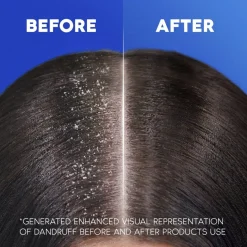 Hot Head & Shoulders Classic Shampoo met Pomp