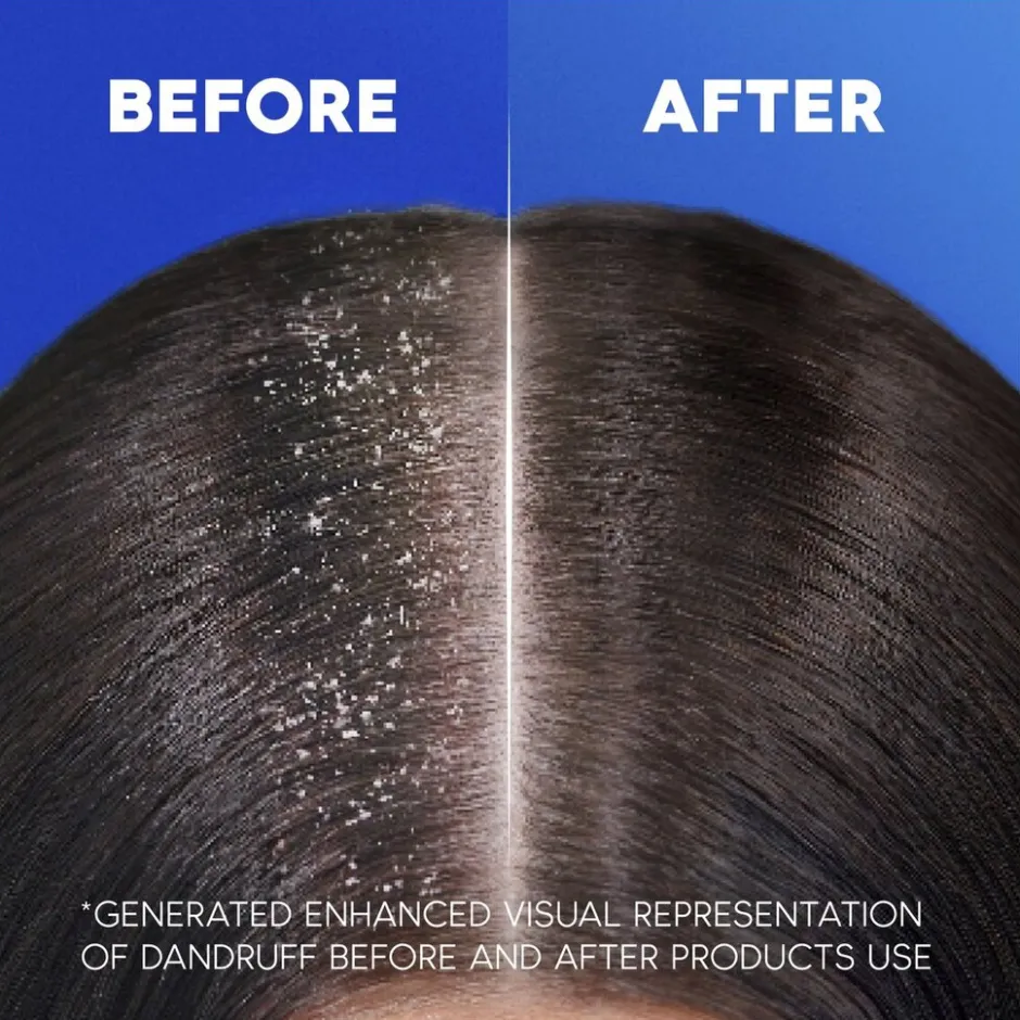 Hot Head & Shoulders Classic Shampoo met Pomp