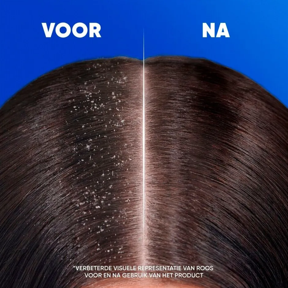 Clearance Head & Shoulders Jeukende Hoofdhuid 2-in-1 Antiroosshampoo