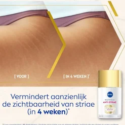 Best Nivea Luminous630 Anti-Striae/Anti-Striemen Body Oil-Serum