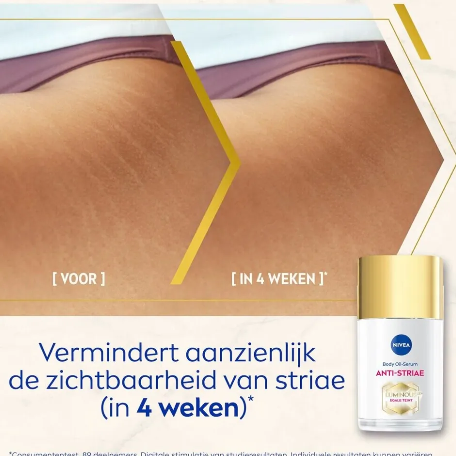 Best Nivea Luminous630 Anti-Striae/Anti-Striemen Body Oil-Serum